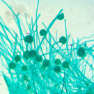 Aflatoxin